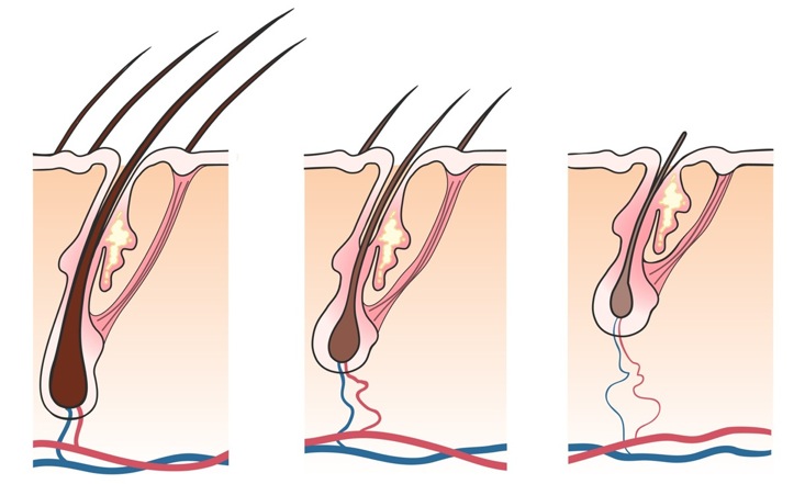 Ciclo vital del cabello. Foto: IML