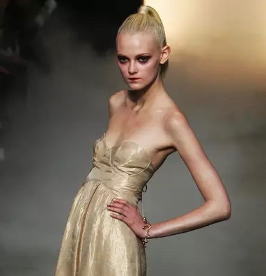 Anorexia