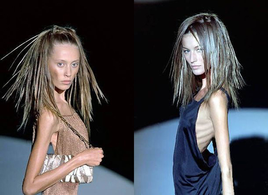 Modelos con anorexia