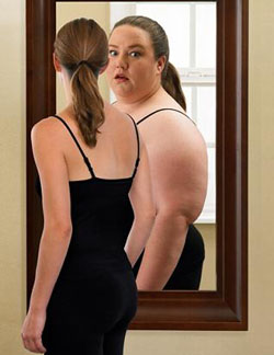 Anorexia